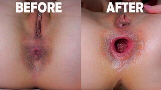 Intense Anal👌 Exploration: Up Close And Personal