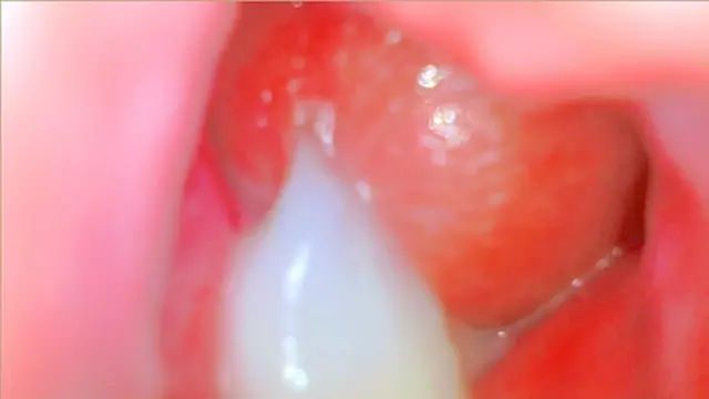 Extreme Close-Up Blowjob - Thick Load In Blonde Shemale From Her Cervix′s View - Pair