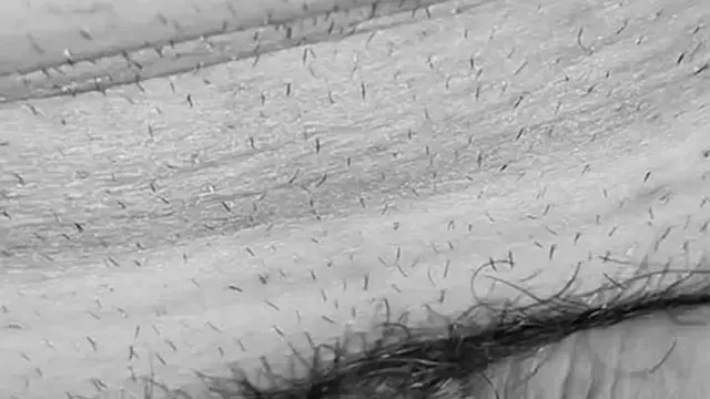 Tiny penises still crave attention